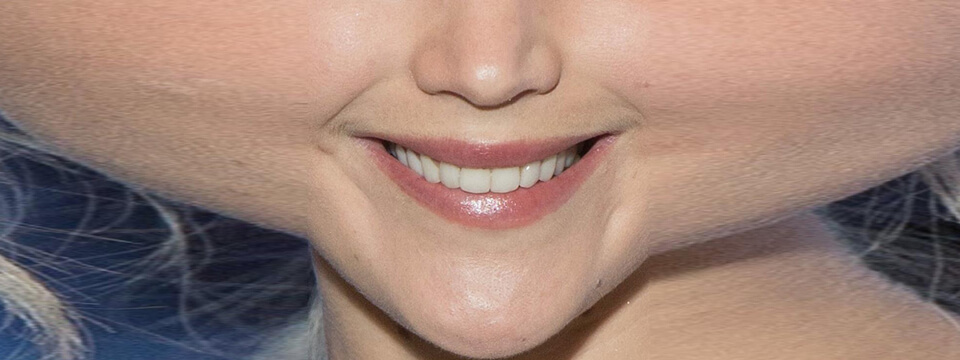 Jennifer Lawrence's stretched selfie